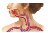 Problemática Oral Asociada al Piercing · Infecciones